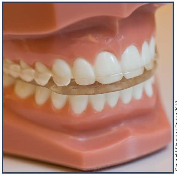 Full-Coverage Splint Appliance (FCS)