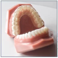 Full Coverage Splint