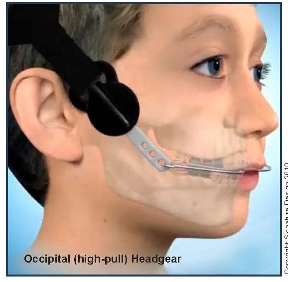 Headgear