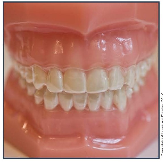 Invisalign® and Other Clear Shells
