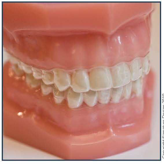 The Essix Appliance