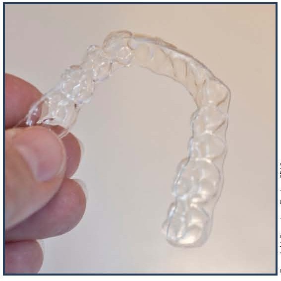 The Essix Appliance