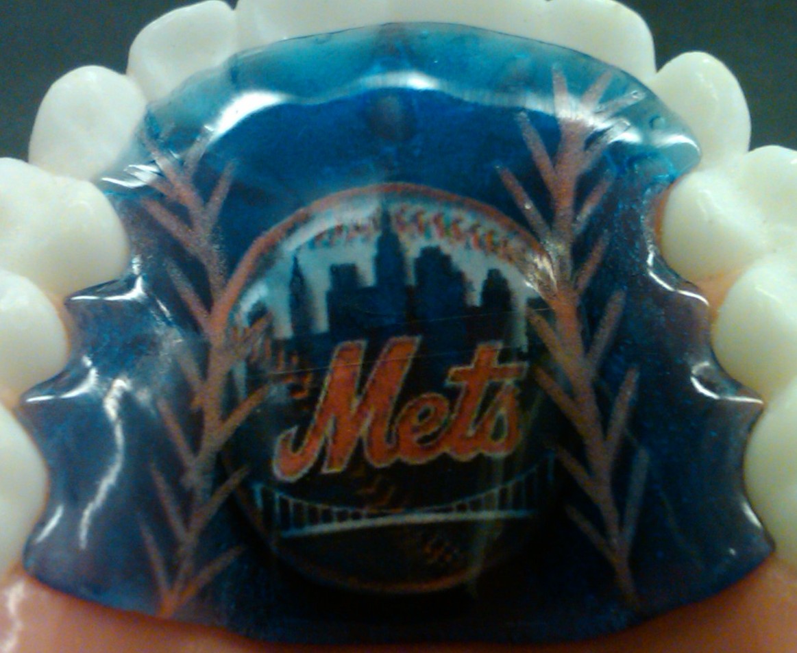 Mets