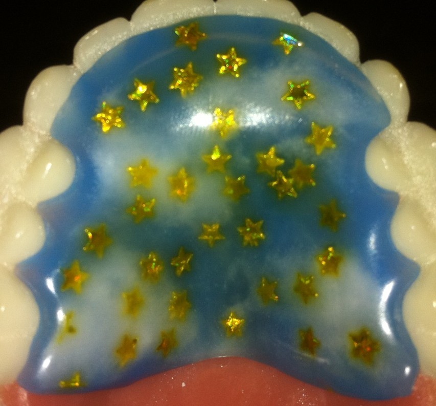 Blue/Yellow Stars